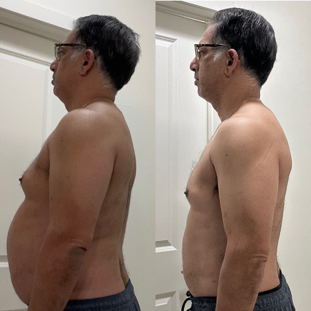 Client before and after