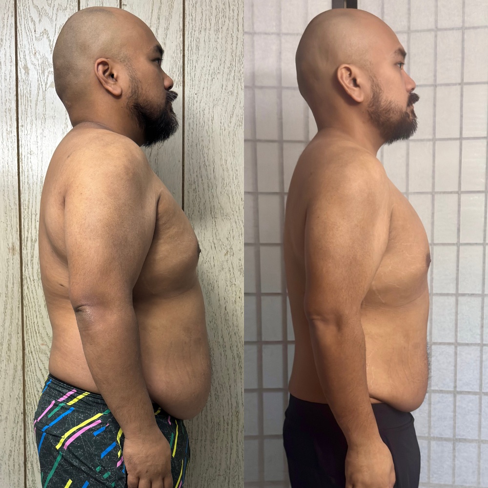 Client before and after